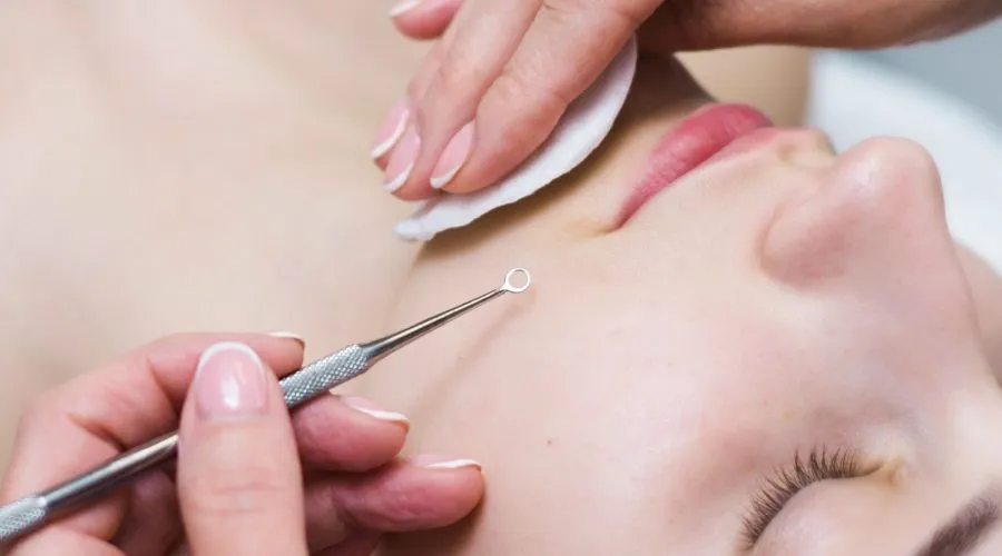 Facial Extractions